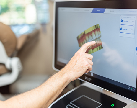 Dentist pointing to computer monitor showing digital model of tooth