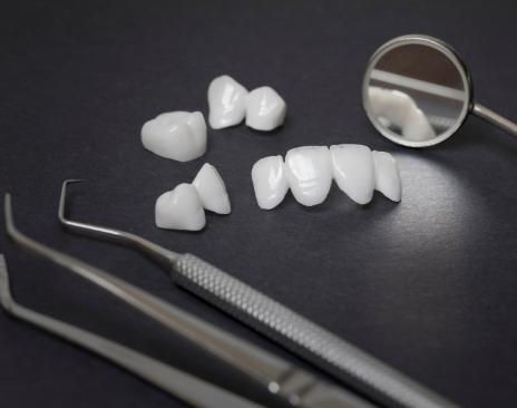 Several white dental crowns and veneers on table next to dental mirrors