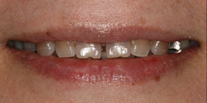 Before cosmetic treatment