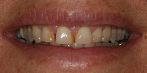 Before cosmetic treatment