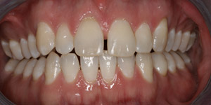 Before cosmetic treatment