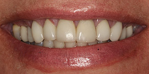 Before cosmetic treatment