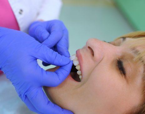 Cosmetic dentist placing a veneer over a tooth