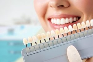 A woman smiling as the dentist determines her tooth color