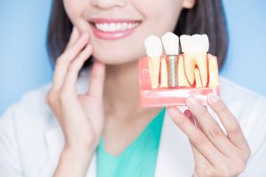 Background of a woman in a white shirt touching her jaw while holding a model of a dental implant in the foreground